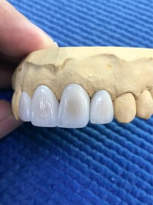 Dental Lithium Disilicate Ceramic Block For CAD Progra Mill Blocks