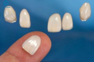 Laboratorio dentale Impiallacciature Restaurazione Estetica Immediata secondu u standard CE/ISO Press Lithium Disicatefor