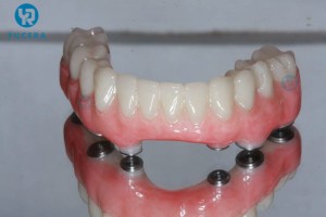 Dentala PMMA-Disko PINK Klara Glorious Lab Cadcam-disko estetika denta laboratorio pmma rozkolora luksozirkonio dentala uzado