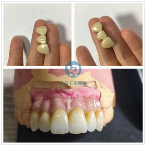 Factory Price  CE Certificate 3D Multilayer Dental Zirconia Block Colored For Milling Machine