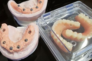 Високо естетични и функционални зъбни протези Многослоен блок от акрилна смола PMMA