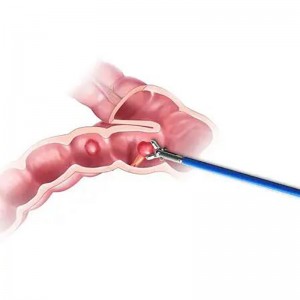 Disposable Endoscopy Colonoscopy Rotating Biopsy Forceps